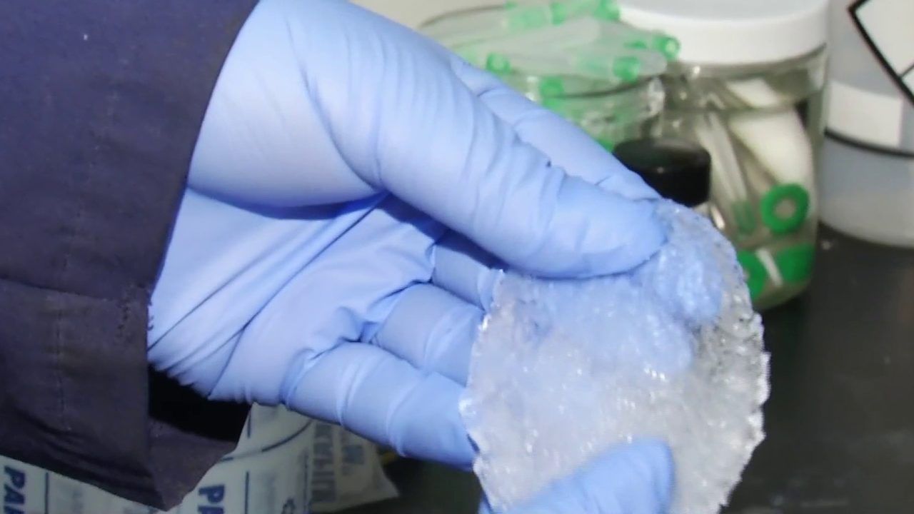 New cervical cancer treatment research happening at